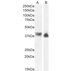 Macrophage-Capping Protein (CAPG) Antibody