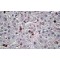 C-C Motif Chemokine 20 / MIP3A (CCL20) Antibody
