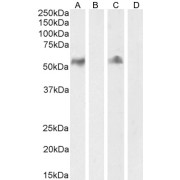 Western blot analysis of Human Lymph node (A) Lymph node blocked by peptide (B) and Tonsil (C) tonsil blocked with peptide (D) lysate (35 µg protein in RIPA buffer) using Cluster Of Differentiation 14 (CD14) Antibody (2 µg/ml).