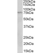 abx432466