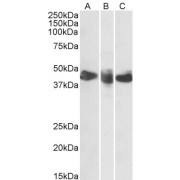 abx432467 (0.3 µg/ml) staining of Human Spleen (A), Tonsil (B) and Thymus (C) lysates (35 µg protein in RIPA buffer). Primary incubation was 1 hour. Detected by chemiluminescence.