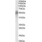 CD2 Antigen Cytoplasmic Tail-Binding Protein 2 (CD2BP2) Antibody