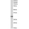 T-Cell Surface Glycoprotein CD4 (CD4) Antibody