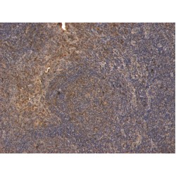 T-Cell Surface Glycoprotein CD4 (CD4) Antibody