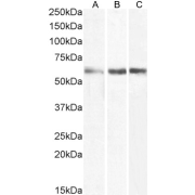 WB analysis using abx432481 (3 ug/ml) of Human Lymph Node (A), Bone Marrow (B) and Spleen (C) lysate.