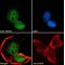 Cat Eye Syndrome Critical Region Protein 2 (CECR2) Antibody
