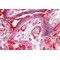 Centaurin Alpha 2 (CENTA2) Antibody