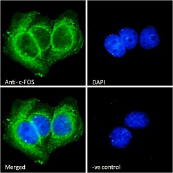 Proto-Oncogene C-Fos (FOS) Antibody