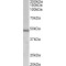 Chitinase 1 (CHIT1) Antibody