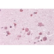 abx432502 (3.8 µg/ml staining of paraffin embedded Human Cortex. Steamed antigen retrieval with citrate buffer pH 6, AP-staining.