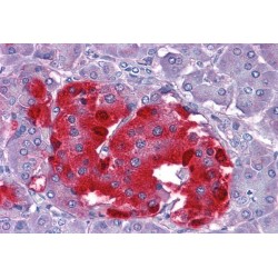 Chromogranin A Precursor (CHGA) Antibody