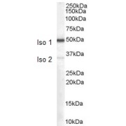 abx432509 (0.1 µg/ml) staining of Human Kidney lysate (35 µg protein in RIPA buffer). Detected by chemiluminescence.