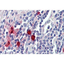 Chymase 1, Mast Cell (CMA1) Antibody
