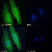 Immunofluorescence analysis of paraformaldehyde fixed HeLa cells, permeabilized with 0.15% Triton. Primary incubation 1hr (10 µg/ml) followed by AF488 secondary antibody (2 µg/ml), showing endoplasmic reticulum staining. The nuclear stain is DAPI (blue). Negative control: Unimmunized goat IgG (10 µg/ml) followed by AF488 secondary antibody (2 µg/ml).
