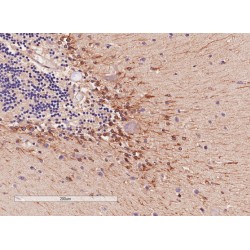 Catechol O-Methyltransferase (COMT) Antibody