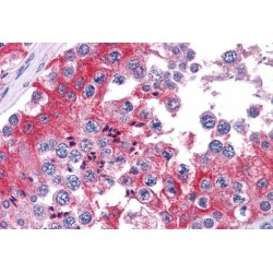 Catechol O-Methyltransferase (COMT) Antibody