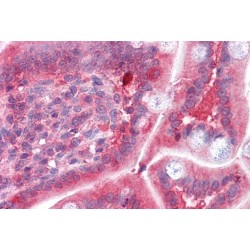 Catechol O-Methyltransferase (COMT) Antibody