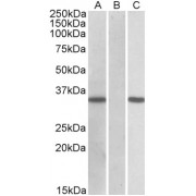 HEK293 lysate (10 µg protein in RIPA buffer) overexpressing Human CRISP2 with C-terminal MYC tag probed with abx432553 (0.11 µg/ml) in Lane A and probed with anti-MYC Tag (1/1000) in lane C. Mock-transfected HEK293 probed with abx432553 (1mg/ml) in Lane B. Primary incubations were for 1 hour. Detected by chemiluminescence.