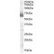 Steroid 17-Alpha-Hydroxylase/17,20 Lyase (CYP17A1) Antibody