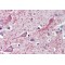 Cytochrome P450 26A1 (CYP26A1) Antibody