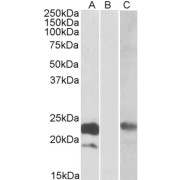 HEK293 lysate (10 µg protein in RIPA buffer) overexpressing Human CST8 with C-terminal MYC tag probed with abx432576 (0.3 µg/ml) in Lane A and probed with anti-MYC Tag (1/1000) in lane C. Mock-transfected HEK294 probed with abx432575 (1mg/ml) in Lane B. Primary incubations were for 1 hour. Detected by chemiluminescence.