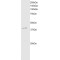 Death-Associated Protein Kinase 2 (DAPK2) Antibody