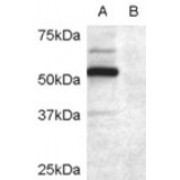 abx432594 (0.2 µg/ml) staining of COS7 cell lysate transfected with full length recombinant human DCDC2 (A) and untransfected control COS7 cells (B). Primary incubation was 1 hour. Detected by chemiluminescence.
