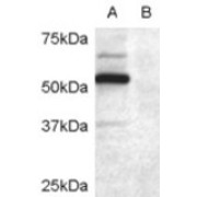 abx432594 (0.2 µg/ml) staining of COS7 cell lysate transfected with full length recombinant human DCDC2 (A) and untransfected control COS7 cells (B). Primary incubation was 1 hour. Detected by chemiluminescence.