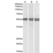 abx432597 (0.3 µg/ml) staining of Daudi (A), Jurkat (B) and HepG2 (C) lysates (35 µg protein in RIPA buffer). Detected by chemiluminescence.