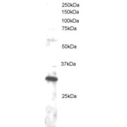 abx432610 staining (1 µg/ml) of Jurkat lysate (RIPA buffer, 30 µg total protein per lane). Primary incubated for 1 hour. Detected by western blot using chemiluminescence.