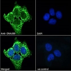 Microvascular Endothelial Differentiation Gene 1 Protein (DNAJB9) Antibody