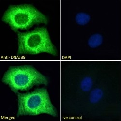 Microvascular Endothelial Differentiation Gene 1 Protein (DNAJB9) Antibody