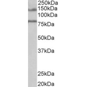 abx432635 (1 µg/ml) staining of Human Brain (Hippocampus) lysate (35 µg protein in RIPA buffer). Primary incubation was 1 hour. Detected by chemiluminescence.