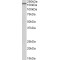 Epidermal Growth Factor Receptor (EGFR) Antibody