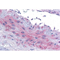 Eukaryotic Translation Initiation Factor 5A-1 (eIF5A) Antibody