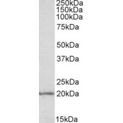 abx432645 (0.1 µg/ml) staining of MOLT4 lysate (35 µg protein in RIPA buffer). Detected by chemiluminescence.