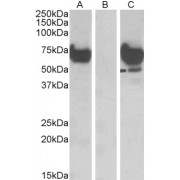 HEK293 lysate (10 µg protein in RIPA buffer) overexpressing Human EPM2AIP1 with DYKDDDDK tag probed with abx432659 (1 µg/ml) in Lane A and probed with anti-DYKDDDDK Tag (1/1000) in lane C. Mock-transfected HEK293 probed with abx432659 (1mg/ml) in Lane B. Primary incubations were for 1 hour. Detected by chemiluminescence.