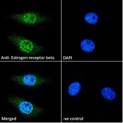 Estrogen Receptor 2 (ESR2) Antibody