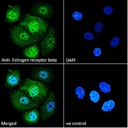 Estrogen Receptor 2 (ESR2) Antibody