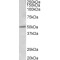 Estrogen Receptor 2 (ESR2) Antibody