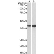 abx432669 (0.2 µg/ml) staining of HepG2 (A) and Jurkat (B) lysates (35 µg protein in RIPA buffer). Detected by chemiluminescence.
