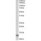Fatty Acid-Binding Protein 4, Adipocyte (FABP4) Antibody