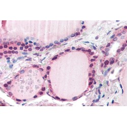 F-Box And Leucine Rich Repeat Protein 3 (FBXL3) Antibody
