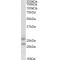 F-Box Only Protein 44 (FBXO44) Antibody