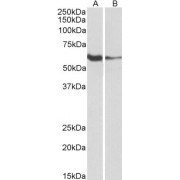 abx432685 (1 µg/ml) staining of Human Tonsil (A) and Daudi (B) lysates (35 µg protein in RIPA buffer). Primary incubation was 1 hour. Detected by chemiluminescence.
