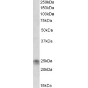 abx432688 (2 µg/ml) staining of Jurkat lysate (35 µg protein in RIPA buffer). Primary incubation was 1 hour. Detected by chemiluminescence.