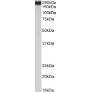 abx432699 (0.1 µg/ml) staining of Human Uterus lysate (35 µg protein in RIPA buffer). Primary incubation was 1 hour. Detected by chemiluminescence.