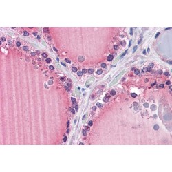 Frizzled Homolog 9 (FZD9) Antibody