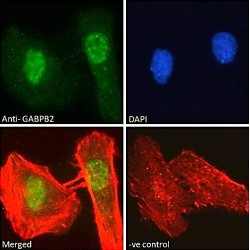 GA Binding Protein Subunit Beta 1 (GABPB1) Antibody