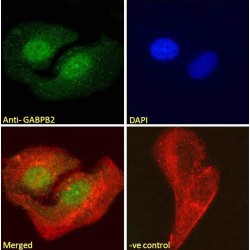 GA Binding Protein Subunit Beta 1 (GABPB1) Antibody